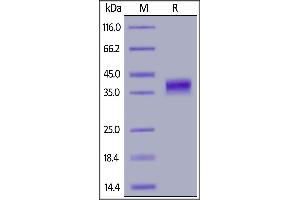 SDS-PAGE (SDS) image for Folate Receptor 1 (Adult) (FOLR1) (AA 25-233) (Active) protein (His tag) (ABIN6952269)