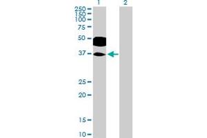 Western Blot analysis of RHOXF2 expression in transfected 293T cell line by RHOXF2 MaxPab polyclonal antibody. (RHOXF2 抗体  (AA 1-288))