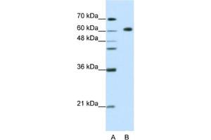 Western Blotting (WB) image for anti-Glucocorticoid Modulatory Element Binding Protein 2 (GMEB2) antibody (ABIN2461836) (GMEB2 抗体)