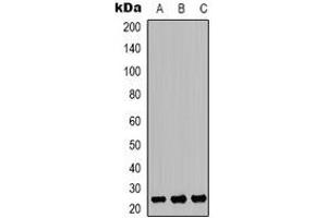 Western blot analysis of TP53INP2 expression in SHSY5Y (A), HEK293T (B), mouse kidney (C) whole cell lysates. (TP53INP2 抗体  (C-Term))