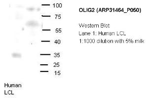 Image no. 2 for anti-Oligodendrocyte Lineage Transcription Factor 2 (OLIG2) (N-Term) antibody (ABIN2777314) (OLIG2 抗体  (N-Term))
