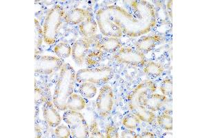 Immunohistochemistry of paraffin-embedded rat kidney using WRB antibody at dilution of 1:200 (40x lens). (WRB 抗体)