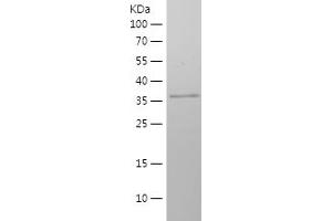 Western Blotting (WB) image for CD36 (CD36) (AA 42-178) protein (His-IF2DI Tag) (ABIN7122203) (CD36 Protein (CD36) (AA 42-178) (His-IF2DI Tag))