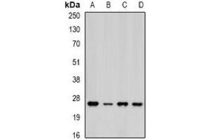 Western blot analysis of PSMA5 expression in MCF7 (A), HepG2 (B), mouse liver (C), mouse heart (D) whole cell lysates. (PSMA5 抗体)