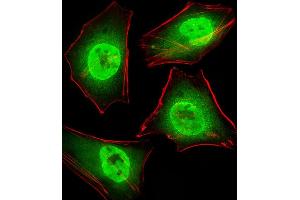 Fluorescent image of Hela cells stained with GTF2I Antibody (C-term) (ABIN390868 and ABIN2841085). (GTF2I 抗体  (C-Term))