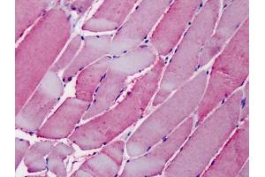 Human Skeletal Muscle: Formalin-Fixed, Paraffin-Embedded (FFPE) (OSBPL1A 抗体  (C-Term))