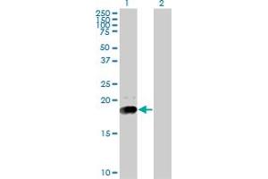 Western Blot analysis of NPC2 expression in transfected 293T cell line by NPC2 monoclonal antibody (M01), clone 4B9. (NPC2 抗体  (AA 1-151))