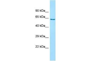 WB Suggested Anti-ANKFY1 Antibody Titration: 1. (ANKFY1 抗体  (C-Term))