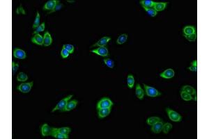 Immunofluorescent analysis of HepG2 cells using ABIN7155128 at dilution of 1:100 and Alexa Fluor 488-congugated AffiniPure Goat Anti-Rabbit IgG(H+L) (HNRPLL 抗体  (AA 1-72))