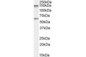 Western Blotting (WB) image for anti-Caspase Recruitment Domain Family, Member 11 (CARD11) (C-Term) antibody (ABIN2465495) (CARD11 抗体  (C-Term))