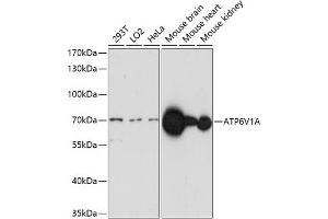 Western Blotting (WB) image for anti-ATPase, H+ Transporting, Lysosomal 70kDa, V1 Subunit A (ATP6V1A) (AA 500-600) antibody (ABIN7265765)