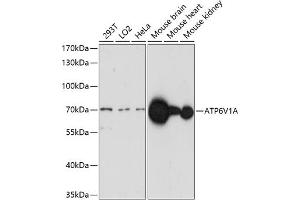 Western blot analysis of extracts of various cell lines, using V1A antibody (ABIN7265765) at 1:1000 dilution. (ATP6V1A 抗体  (AA 500-600))
