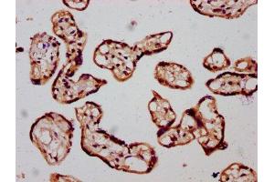 Immunohistochemistry (IHC) image for anti-Solute Carrier Family 26 (Sulfate Transporter), Member 2 (SLC26A2) (AA 614-739) antibody (ABIN7170935)