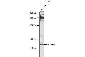 Western blot analysis of extracts of Mouse lung, using GNRH1 antibody (ABIN6131875, ABIN6141257, ABIN6141258 and ABIN6221260) at 1:1000 dilution. (GNRH1 抗体  (AA 24-92))