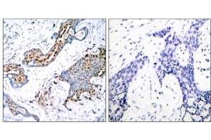 Image no. 1 for anti-Estrogen Receptor 1 (ESR1) (pSer118) antibody (ABIN196742) (Estrogen Receptor alpha 抗体  (pSer118))