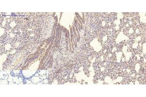 Immunohistochemistry of paraffin-embedded Rat lung tissue using COL4A1 Monoclonal Antibody at dilution of 1:200. (COL4A1 抗体)
