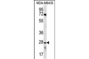 Western blot analysis in MDA-MB435 cell line lysates (35ug/lane). (OR10AG1 抗体  (C-Term))