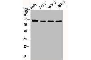 Western Blot analysis of HELA PC3 MCF7 22RV1 cells using Phospho-PKC ζ (T410) Polyclonal Antibody (PKC zeta 抗体  (pThr410))