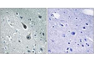 Immunohistochemistry analysis of paraffin-embedded human brain tissue, using 5-HT-2A Antibody. (HTR2A 抗体  (AA 422-471))