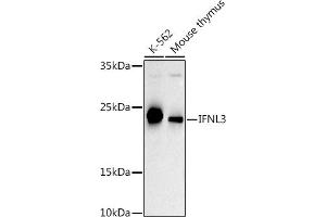 Western blot analysis of extracts of various cell lines, using IFNL3 antibody (ABIN6132858, ABIN6142207, ABIN6142209 and ABIN6221289) at 1:500 dilution. (IL28B 抗体  (AA 22-196))