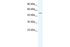 WB Suggested Anti-TPTE Antibody Titration:  1. (TPTE 抗体  (C-Term))