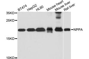 Western blot analysis of extracts of various cell lines, using NPPA antibody. (NPPA 抗体)