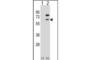 Western blot analysis of ZBTB7B (arrow) using rabbit polyclonal ZBTB7B Antibody (Center) (ABIN1538297 and ABIN2848651). (ZBTB7B 抗体  (AA 315-343))