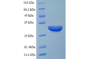 SDS-PAGE (SDS) image for Receptor (TNFRSF)-Interacting serine-threonine Kinase 1 (RIPK1) (AA 24-269) protein (His tag) (ABIN5714046)