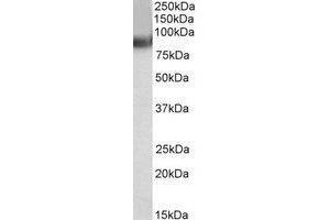AP22452PU-N TRIM55 antibody staining of Human Heart lysate at 0. (TRIM55 抗体  (C-Term))