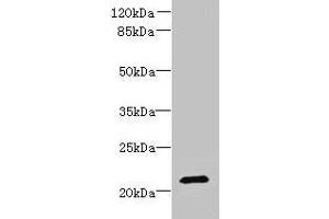 Western blot All lanes: DYDC1 antibody at 4 μg/mL + Hela whole cell lysate Secondary Goat polyclonal to rabbit IgG at 1/10000 dilution Predicted band size: 21, 22 kDa Observed band size: 21 kDa (DYDC1 抗体  (AA 1-177))