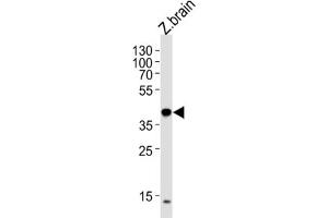 Western Blotting (WB) image for anti-Eukaryotic Translation Initiation Factor 3 Subunit E (EIF3E) antibody (ABIN3000922) (EIF3E 抗体)