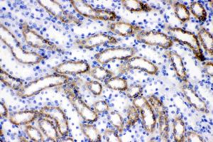 Immunohistochemistry (IHC) image for anti-Acyl-CoA Synthetase Long-Chain Family Member 1 (Acsl1) (AA 604-698) antibody (ABIN4886418)