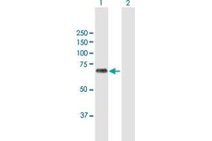 Western Blot analysis of BIRC3 expression in transfected 293T cell line by BIRC3 MaxPab polyclonal antibody. (BIRC3 抗体  (AA 1-604))