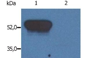 Western Blotting analysis (reducing conditions) of GFAP in porcine brain lysate. (GFAP 抗体)