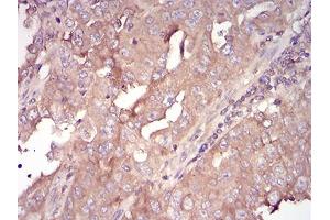Immunohistochemistry (IHC) image for anti-serpin Peptidase Inhibitor, Clade A (Alpha-1 Antiproteinase, Antitrypsin), Member 3 (SERPINA3) (AA 279-432) antibody (ABIN5684069)