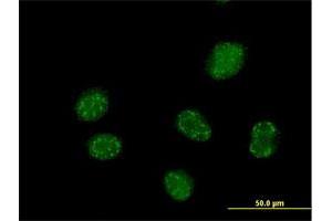 Immunofluorescence of purified MaxPab antibody to ELAC1 on HeLa cell. (ELAC1 抗体  (AA 1-363))