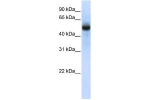CXORF34 antibody used at 1 ug/ml to detect target protein. (TRMT2B 抗体  (N-Term))