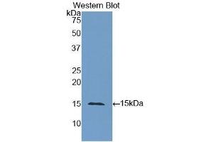 Detection of Recombinant CEA, Human using Polyclonal Antibody to Carcinoembryonic Antigen (CEA) (CEA 抗体  (AA 448-572))