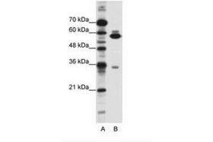 Image no. 1 for anti-Zinc Finger Protein 446 (ZNF446) (C-Term) antibody (ABIN202554) (ZNF446 抗体  (C-Term))