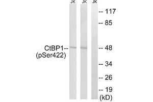 Western blot analysis of extracts from Jurkat cells treated with TNF using CtBP1 (Phospho-Ser422) Antibody. (CTBP1 抗体  (pSer422))