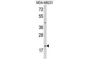 Western blot analysis of IL12A Antibody (C-term) in MDA-MB231 cell line lysates (35ug/lane). (IL12A 抗体  (C-Term))