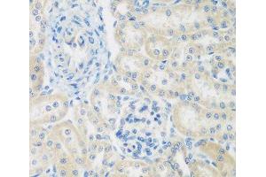 Immunohistochemistry of paraffin-embedded Rat kidney using ENPEP Polyclonal Antibody at dilution of 1:200 (40x lens). (ENPEP 抗体)