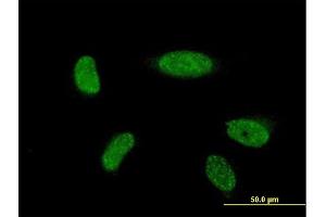 Immunofluorescence of monoclonal antibody to ATOH1 on HeLa cell. (ATOH1 抗体  (AA 266-354))