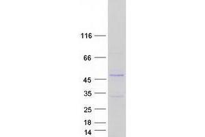 Western Blotting (WB) image for Zinc Finger, FYVE Domain Containing 27 (ZFYVE27) (Transcript Variant 5) protein (Myc-DYKDDDDK Tag) (ABIN2735876)