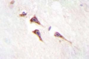 Image no. 2 for anti-Mechanistic Target of Rapamycin (serine/threonine Kinase) (mTOR) antibody (ABIN272127) (MTOR 抗体)