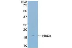 Detection of Recombinant TPS, Mouse using Polyclonal Antibody to Tryptase (TPS) (TPSAB1 抗体  (AA 149-273))