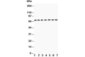 Western blot testing of Lamin A antibody and Lane 1:  human placenta;  2: SKOV;  3: SW620;  4: COLO320;  5: HeLa;  6: 293T;  7: A549 lysate (Lamin A/C 抗体  (AA 481-646))