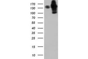 Western Blotting (WB) image for anti-Histone Deacetylase 6 (HDAC6) antibody (ABIN1498620) (HDAC6 抗体)