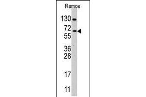 Western blot analysis of CDC25B polyclonal antibody  in Ramos cell line lysates (35 ug/lane). (CDC25B 抗体  (Internal Region))
