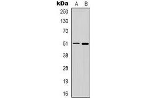 Western blot analysis of GABRD expression in HT29 (A), PC12 (B) whole cell lysates. (GABRD 抗体)